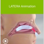 LATERA Animation